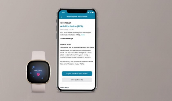 
						Fitbit представила &laquo;умные&raquo; часы Sense с ЭКГ и отслеживанием уровня стресса и Versa 3 с автономностью до 6 дней
					